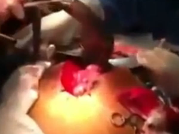 06-1415247653-the-stomach-churning-momen