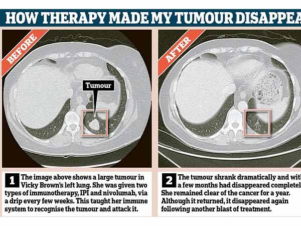 01-1433153184-new-era-war-cancer-revolut