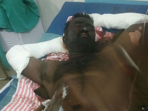 கீழ்ப்பாக்கம் மருத்துவமனையில் 30 பேர்