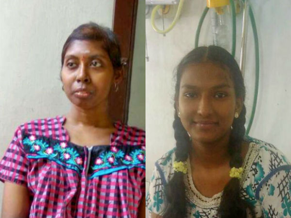 Roshini, Sudhandradevi who were affected by Cancer seeks help for treatment through crowdfunding Roshini, Sudhandradevi who were affected by Cancer seeks help for treatment through crowdfunding