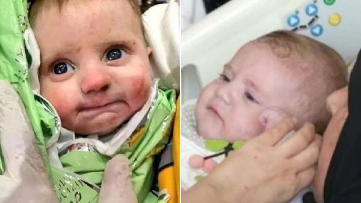 Remember the Turkish miracle baby rescued with the umbilical cord? Find