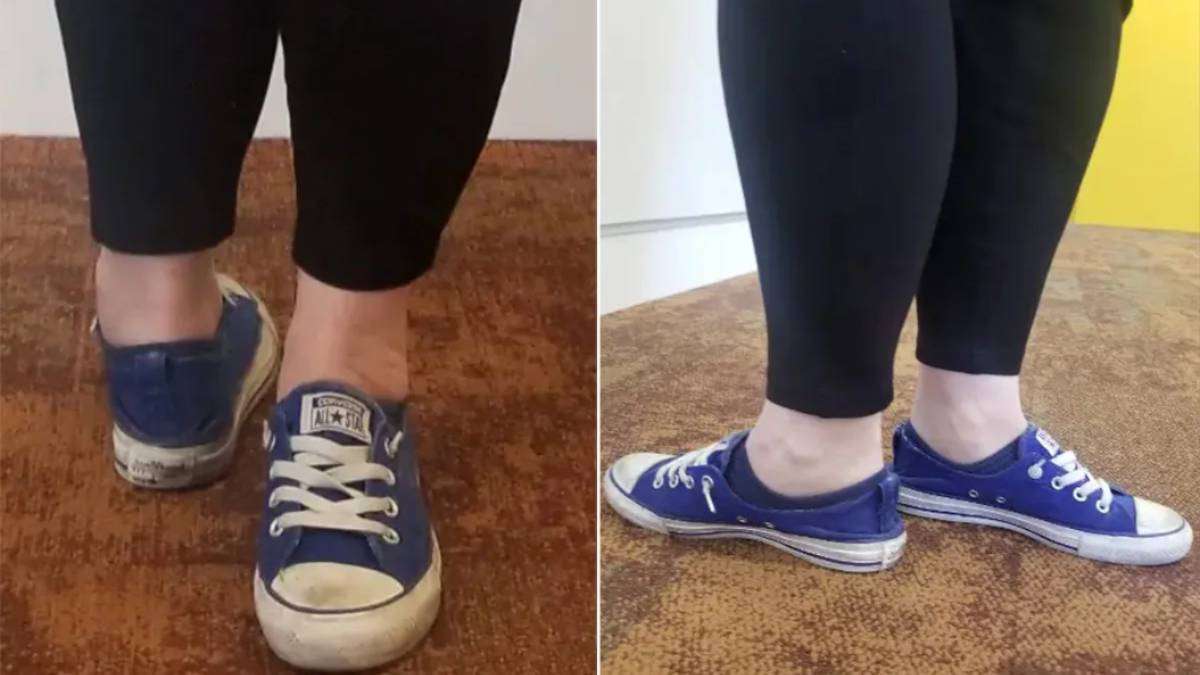 Ah kapan!  Seorang wanita Amerika membalikkan kakinya 180 derajat .. Kelsey ada di Guinness Book!  |  Seorang wanita berusia 32 tahun memutar kakinya dari belakang ke depan sebesar 171 derajat Ah kapan!  Seorang wanita Amerika membalikkan kakinya 180 derajat .. Kelsey ada di Guinness Book!  |  Seorang wanita berusia 32 tahun memutar kakinya dari belakang ke depan sebesar 171 derajat