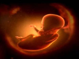 Female Infanticide Female Infanticide