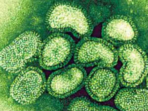 Swine Flu Swine Flu