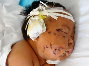 Mother stabs baby 90 times in face wIth scissors for biting nipples while breast feeding Mother stabs baby 90 times in face wIth scissors for biting nipples while breast feeding