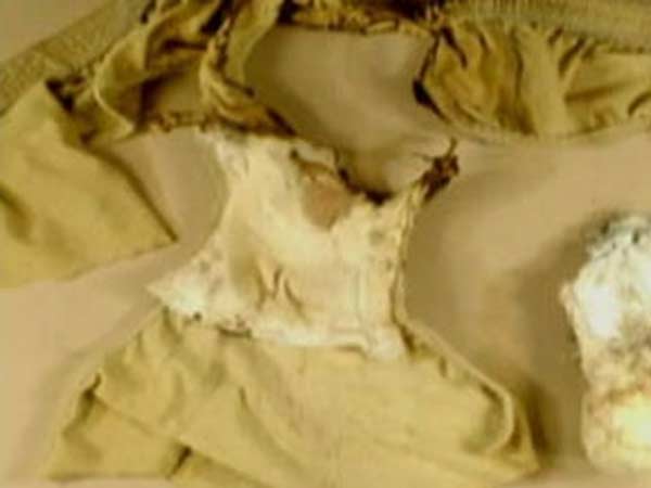 ஒரே ஜட்டியுடன் 2 வாரமாக சுற்றியதால்