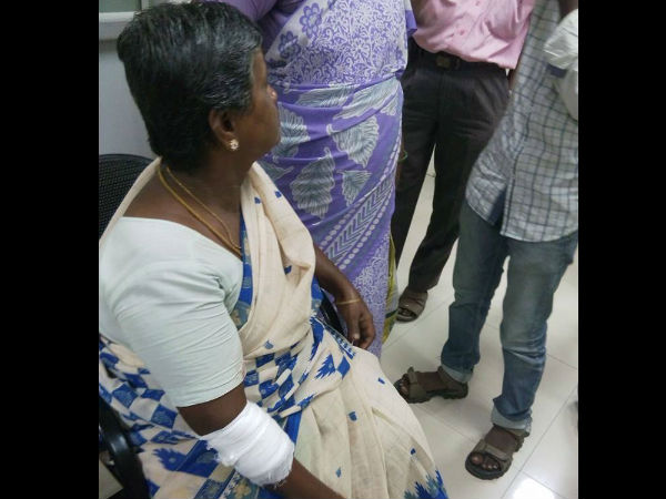 நாய்களைப் பிடிக்க நடவடிக்கை