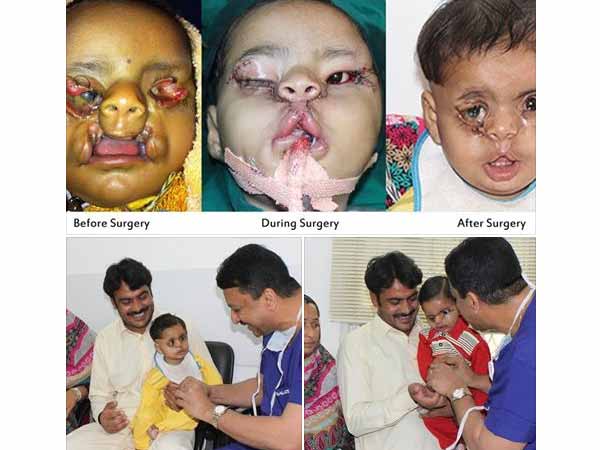 Pakistan boy gets a 'new face' in Chennai Pakistan boy gets a 'new face' in Chennai