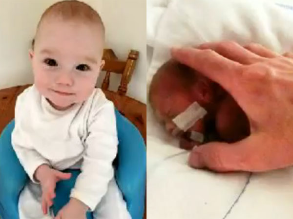 incredible survival of baby born at just 25 weeks incredible survival of baby born at just 25 weeks