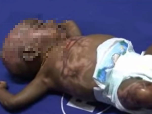 7 days Old Infant Keeps Catching Fire near Vilupuram 7 days Old Infant Keeps Catching Fire near Vilupuram