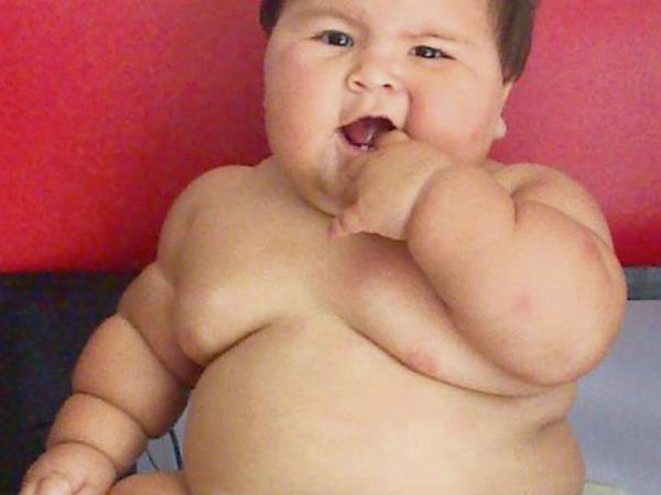 The 10-month-old who weighs as much as a five-year-old The 10-month-old who weighs as much as a five-year-old