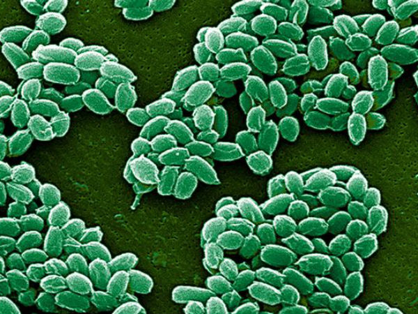 Live anthrax shipped accidentally to S Korea and US labs Live anthrax shipped accidentally to S Korea and US labs