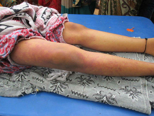 9-year old girl dies after facing punishment in school; parents vandalize school premises 9-year old girl dies after facing punishment in school; parents vandalize school premises