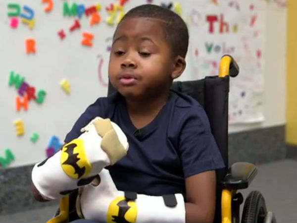 First child double hand transplant announced in US First child double hand transplant announced in US