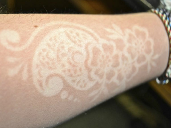 ‘Tan tattoos’ or ‘sunburn art’ gaining popularity among youth ‘Tan tattoos’ or ‘sunburn art’ gaining popularity among youth