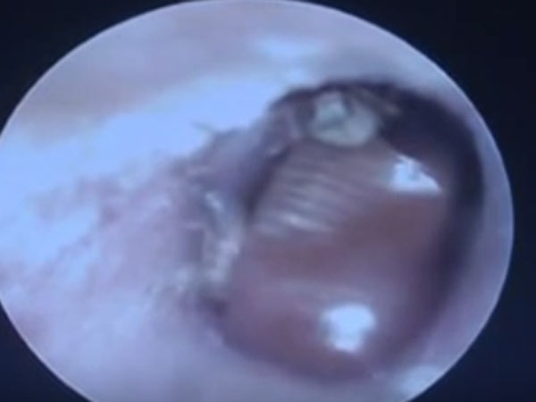 மருத்துவரின் சாதனை