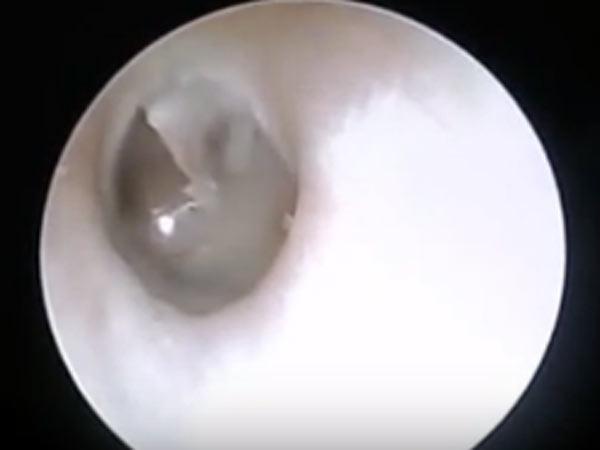 வலியால் துடித்த வாலிபர்
