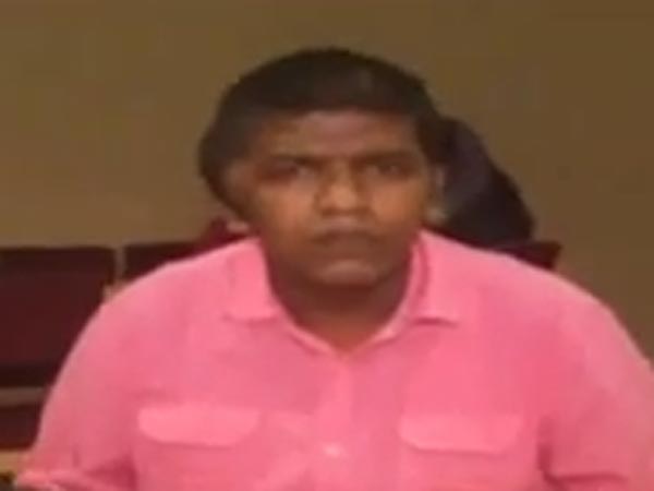 3D Printed Artificial Skull Surgery To man by NIMS Doctors in Hyderabad 3D Printed Artificial Skull Surgery To man by NIMS Doctors in Hyderabad