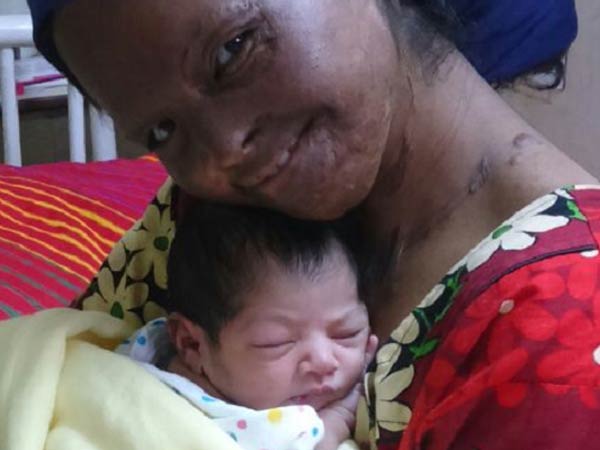 Acid attack survivor Laxmi and her daughter will make you smile Acid attack survivor Laxmi and her daughter will make you smile