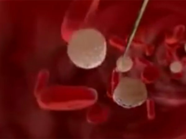பெரியவர்களுக்கும் பிரச்சினை: