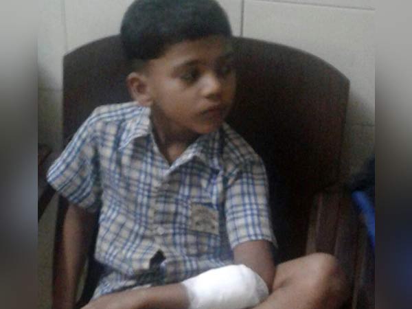சிறுவன் மீது தாக்குதல்