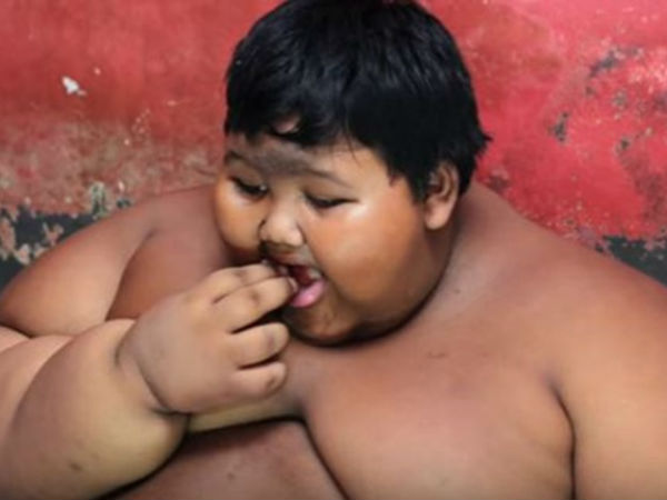 World’s most obese kid is 10-years-old, weighs 192 kg World’s most obese kid is 10-years-old, weighs 192 kg