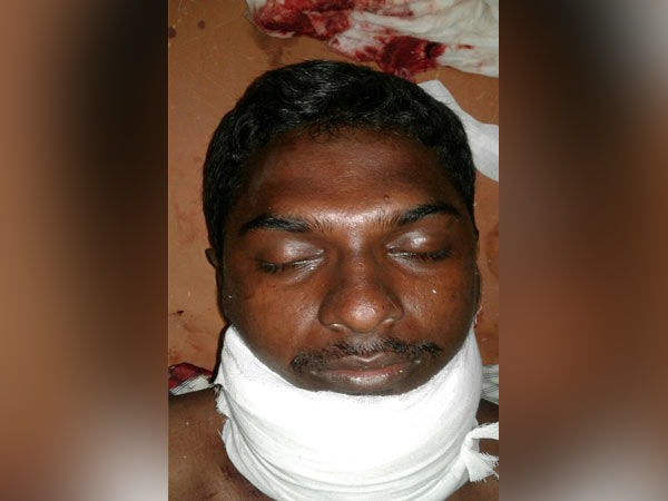 Ramkumar's advocates stage road roko Ramkumar's advocates stage road roko