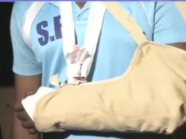 கை எலும்பு முறிந்தது