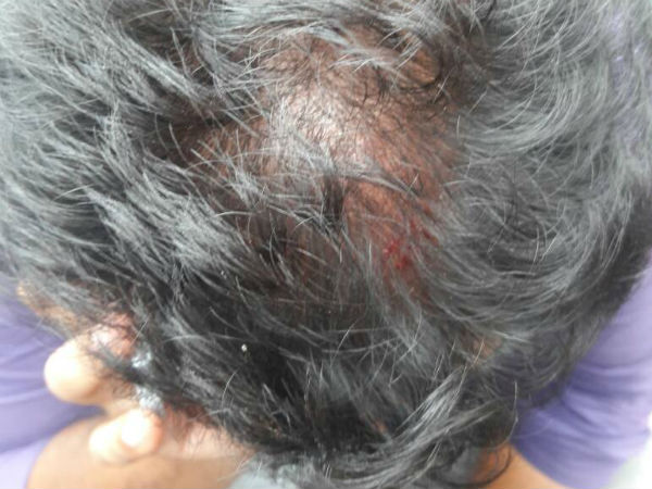 தரதரவென இழுத்தனர்