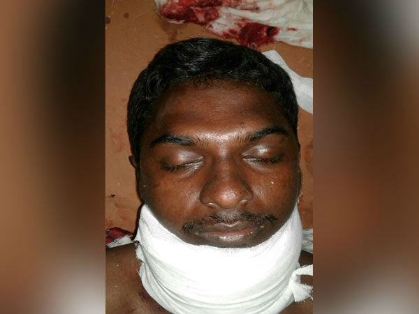 வயரை கடித்து மரணம்