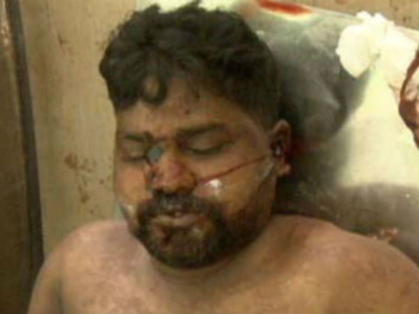 சிகிச்சை அளிக்காததால் பலியான முருகன் குழந்தைகளின் கல்விச் செலவை ஏற்றது கேரள சிபிஎம் 