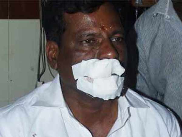 Disqualified MLA Ezhumalai attacked by ADMK cadre Disqualified MLA Ezhumalai attacked by ADMK cadre