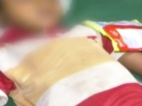 Four year old boy dies after swallowing rubber toy in Andhra Four year old boy dies after swallowing rubber toy in Andhra