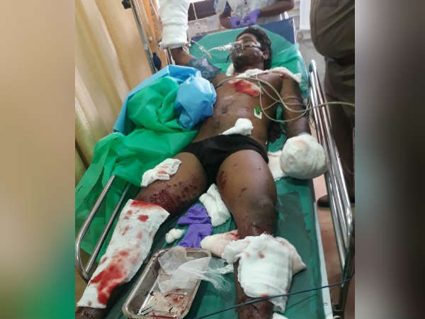 One critically injured in Puducherry blast One critically injured in Puducherry blast