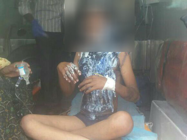 9th std boy burnt near Vellore 9th std boy burnt near Vellore