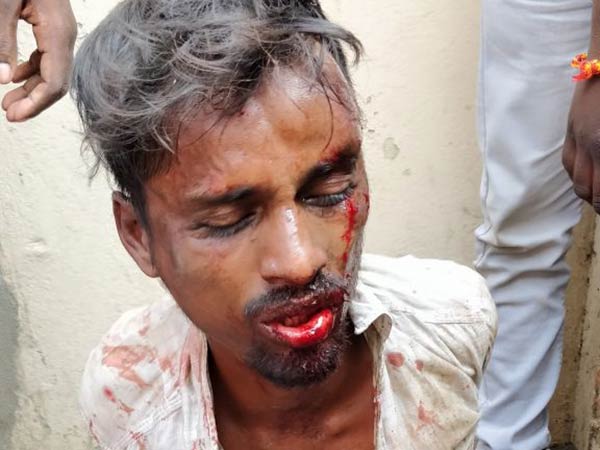அஸ்வினி மீது ஆத்திரம்