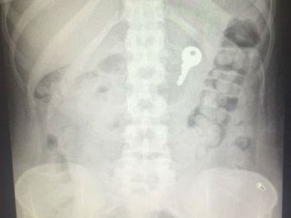 Mp Man Swallows Keys Mp Man Swallows Keys