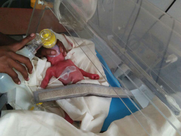 The dead child survived in Nellai The dead child survived in Nellai