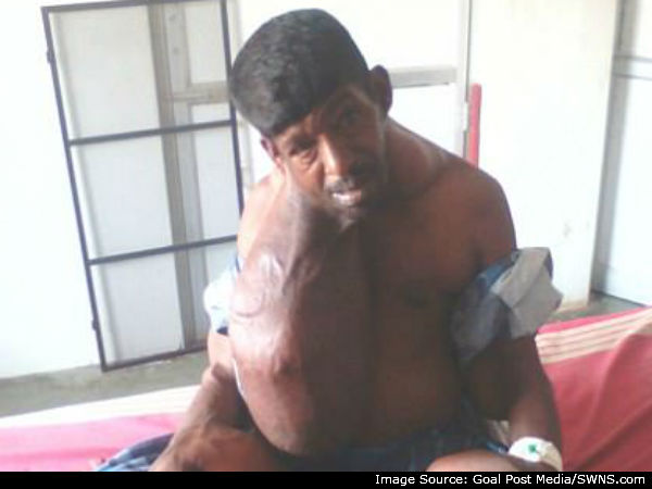 முடக்கம்:
