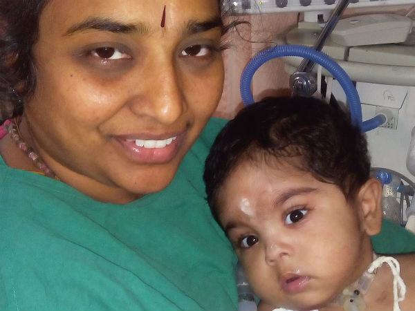 Even after 3 surgeries, this 1-year-old struggles for each breath Even after 3 surgeries, this 1-year-old struggles for each breath