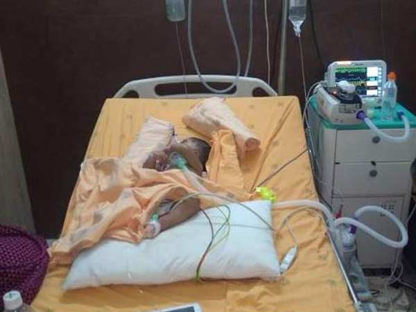 Even after 3 surgeries, this 1-year-old struggles for each breath Even after 3 surgeries, this 1-year-old struggles for each breath