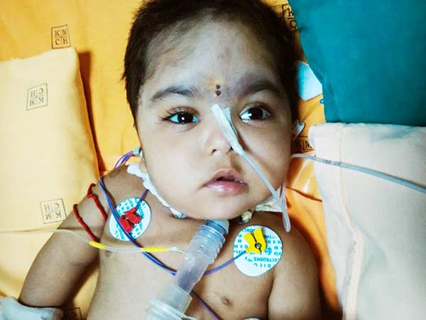 Even after 3 surgeries, this 1-year-old struggles for each breath Even after 3 surgeries, this 1-year-old struggles for each breath