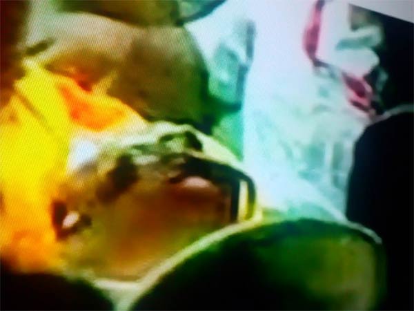 Karunanidhi critical, rushed to hospital past midnight Karunanidhi critical, rushed to hospital past midnight