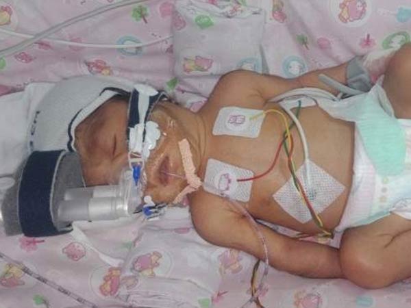Driver’s premature baby girl waits for treatment in NICU Driver’s premature baby girl waits for treatment in NICU