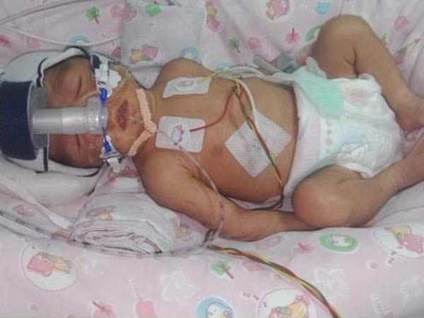 Driver’s premature baby girl waits for treatment in NICU Driver’s premature baby girl waits for treatment in NICU