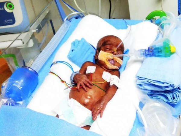 After losing one child, this father fights to save his newborn daughter After losing one child, this father fights to save his newborn daughter