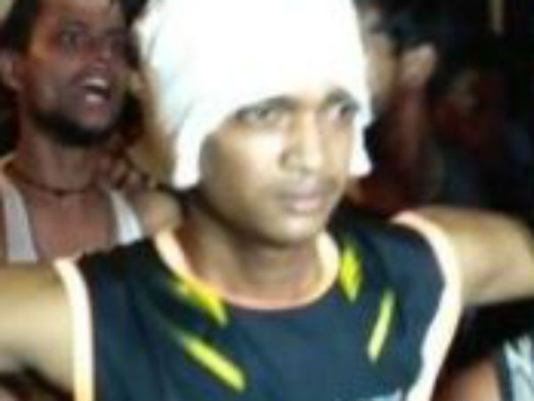 காது துண்டிப்பு