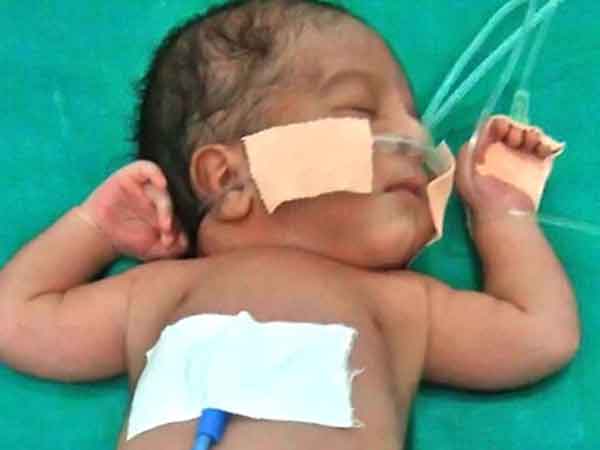 இரட்டை குழந்தைகள்