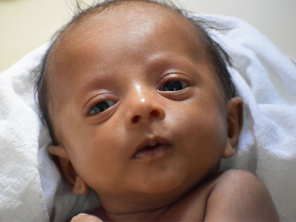 8-Month-Old Anirudh Seeks Your Help For His Final Surgery 8-Month-Old Anirudh Seeks Your Help For His Final Surgery