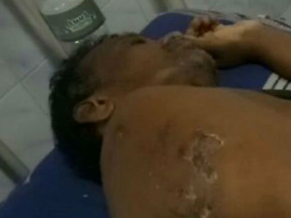வழுக்கி விழுந்திட்டேன்